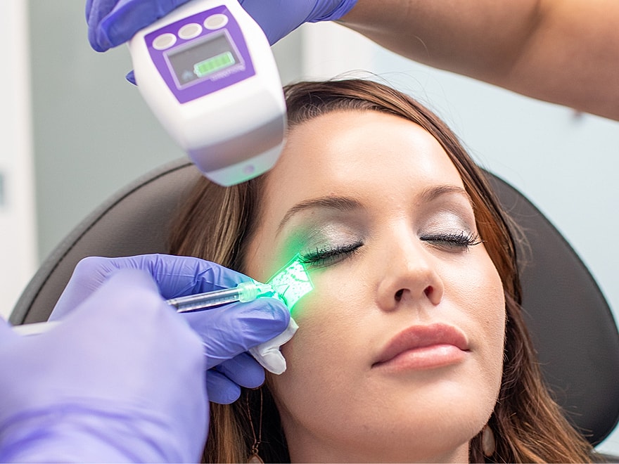 Facial treatment using a green light device