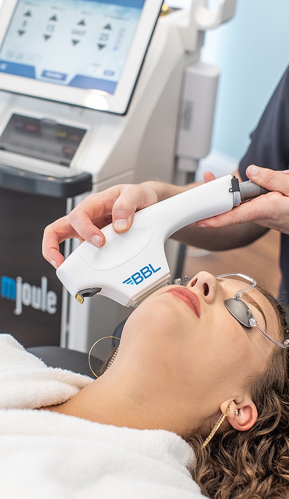 Woman undergoing BBL skin treatment in clinic.